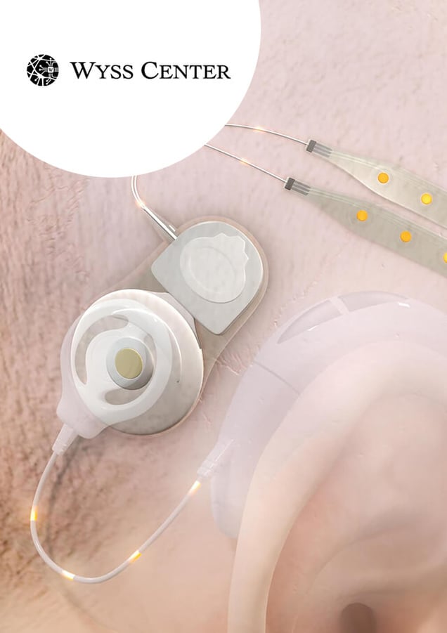 Wyss Center’s Epios™ Cloud solution for monitoring and management of neuro-disorders